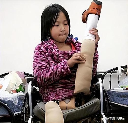 快手里谁见过断腿女孩