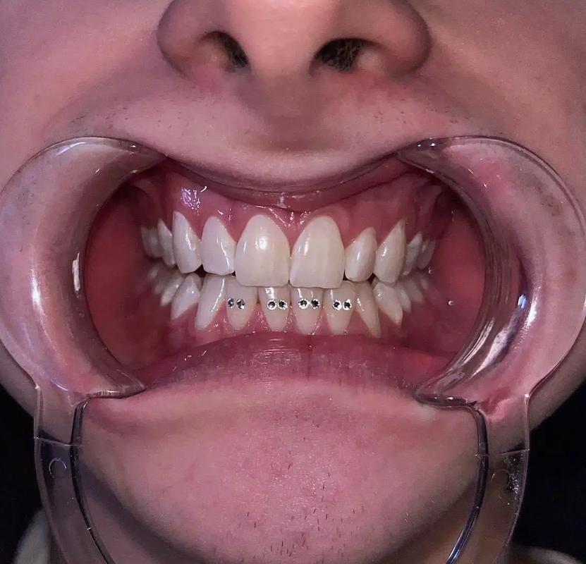 虎牙myth美钻快手