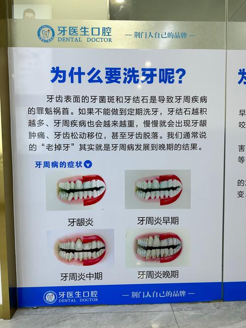 抖音上的洗牙的是什么