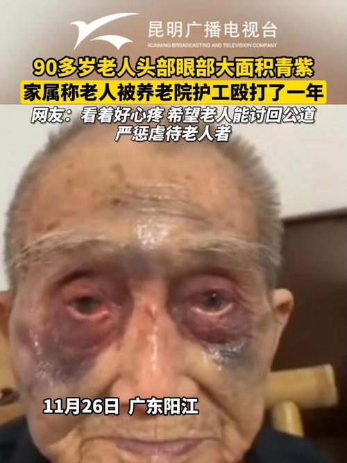 老人打架快手视频下载