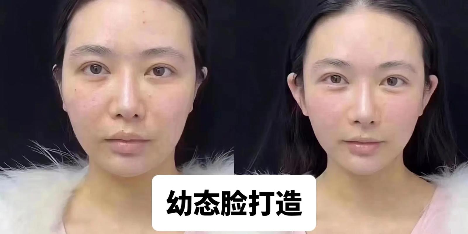 怎么在抖音里把脸变大