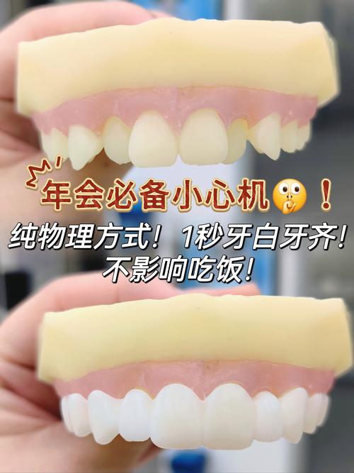 抖音上的牙齿美白神器