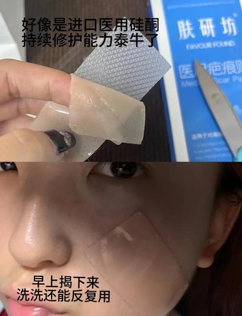 抖音 撕下来 痘痘贴