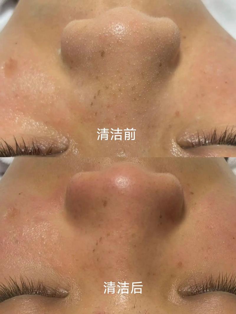 抖音深海泥真的好用吗