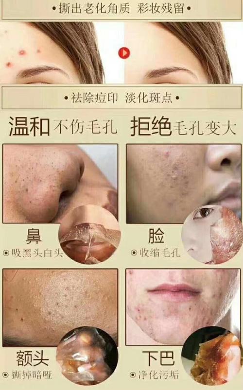 快手上的祛斑撕拉面膜