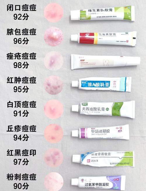 抖音祛痘药膏Pair