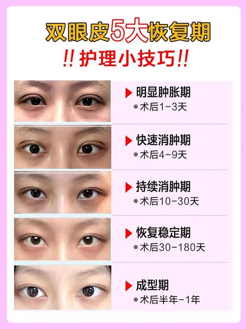 抖音一刷秒变双眼皮