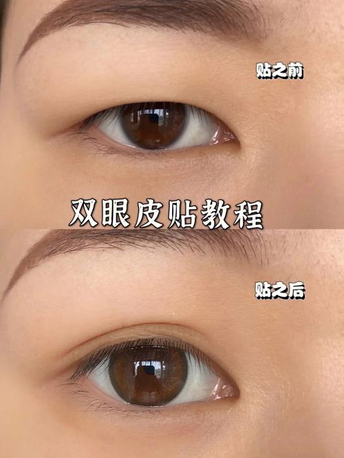 抖音双眼皮贴一根线