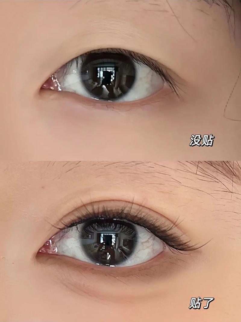 抖音双眼皮贴一根线
