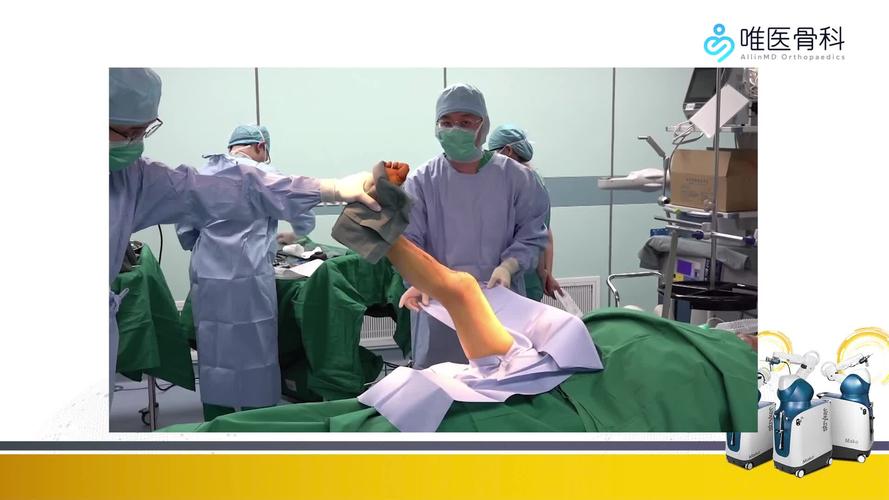 膝关节置换视频直播