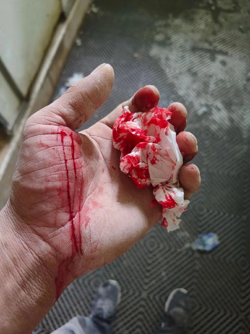 抖音蜡手膜图片破碎